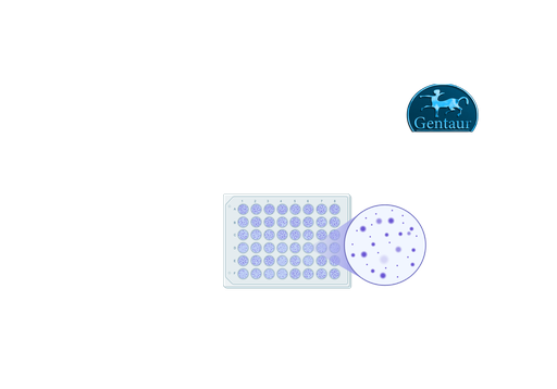 [ESR400M] ELISA Kits SARS-CoV-2 IgM