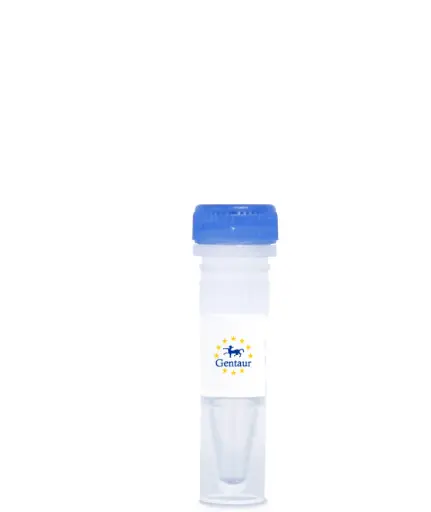 [DASHCHINK-333] CHIKUNGUNYA VIRCLIA® IgG MONOTEST